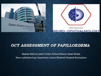 OCT assessment of papilloedema_Page_01